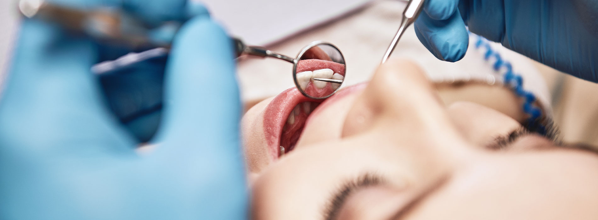 Russell D. Hatfield, DDS, MS, Ltd | Bone Grafting, Sinus Augmentation and Extractions