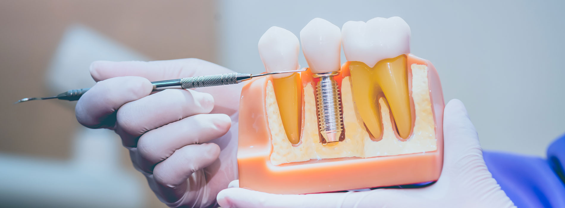 Russell D. Hatfield, DDS, MS, Ltd | Periodontal Exam, Sinus Augmentation and Scaling   Root Planing